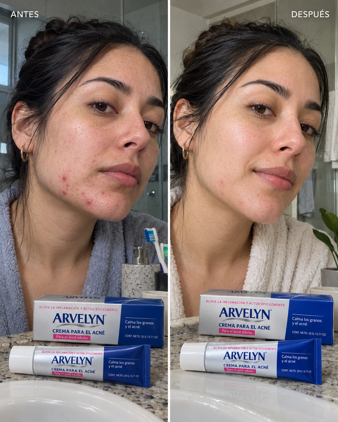 Arvelyn Crema Anti Acné